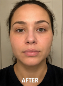Cherisha M. after taking Lymph Drops